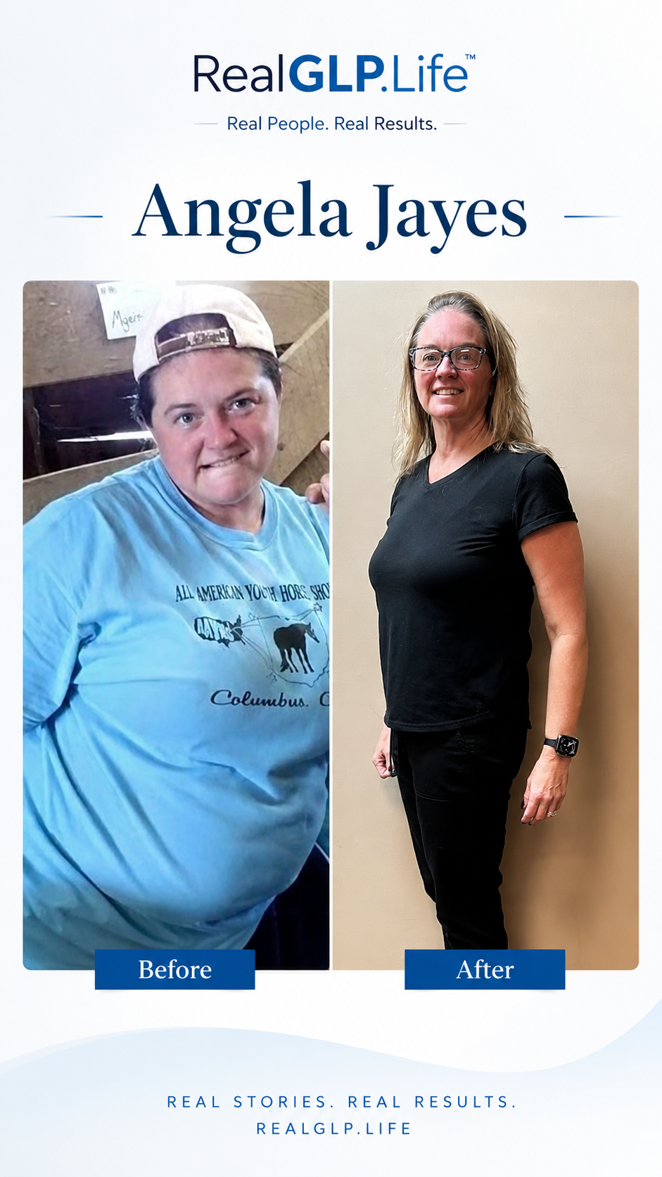 Angela Jayes NP before and after weight loss journey